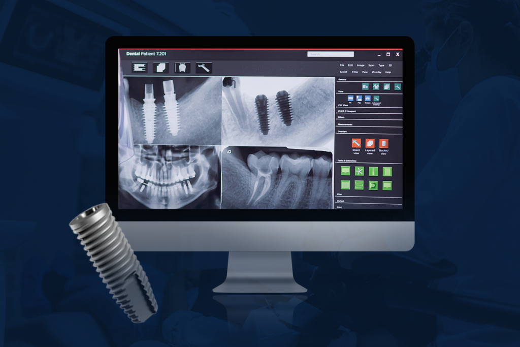 cirurgia guiada
